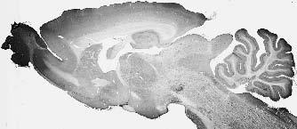Anti-REEP1 Antibody