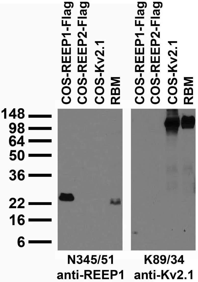 Anti-REEP1 Antibody - Image 2