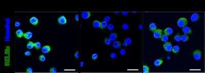 Anti-RELM alpha Antibody