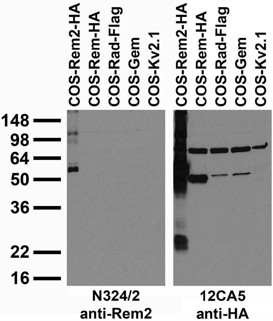 Anti-Rem2 Antibody - Image 3