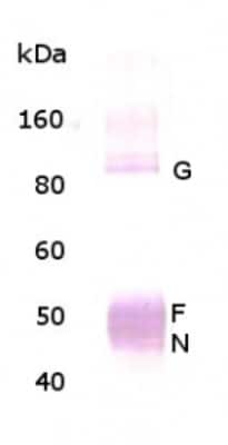 Anti-Respiratory Syncytial Virus Antibody