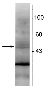 Anti-Retinoid X Receptor, ß-Isotype Antibody