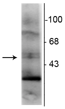 Anti-Retinoid X Receptor, γ-Isotype Antibody