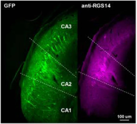 Anti-RGS14 Antibody - Image 13