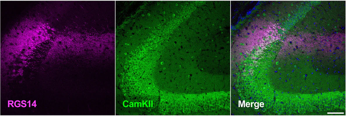 Anti-RGS14 Antibody - Image 7