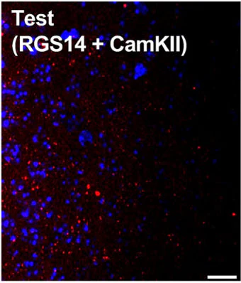 Anti-RGS14 Antibody - Image 8