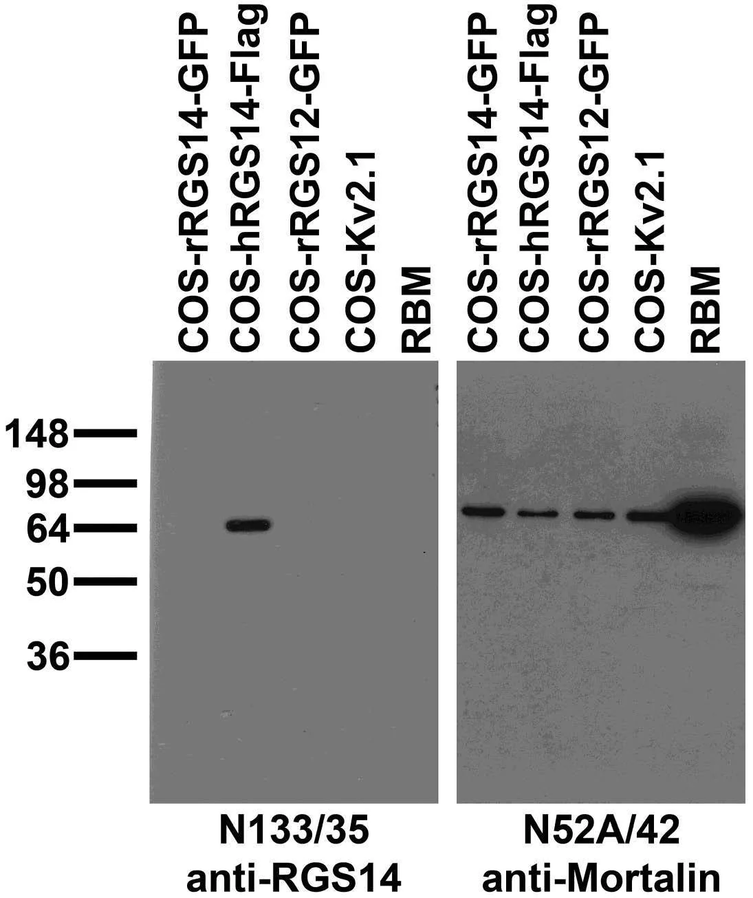 Anti-RGS14 Antibody - Image 2