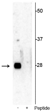 Anti-Ribosomal protein S6 (Ser244) Antibody