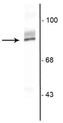 Anti-Ribosomal S6 kinase 2 Antibody