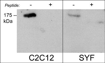 Anti-Robo2 (C-terminal region) Antibody