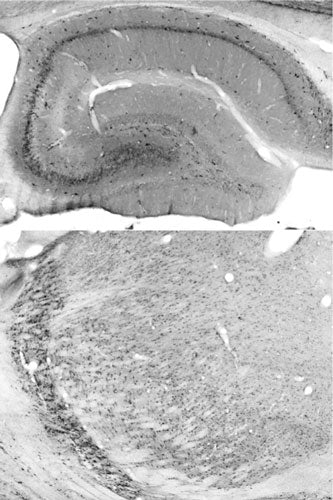 Anti-Rufy3 Antibody
