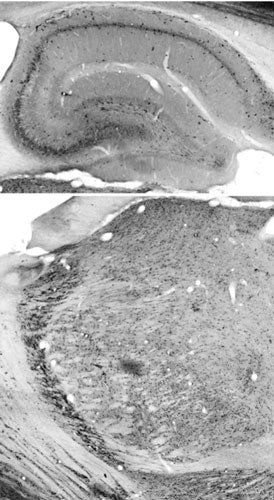 Anti-Rufy3 Antibody