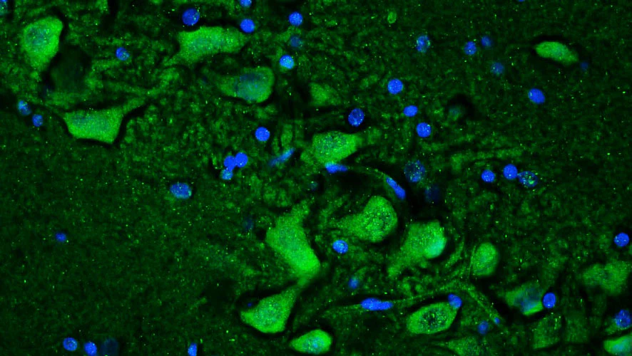 Anti-Ryanodine Receptor Type 2 (RyR2) Recombinant Chicken Chimeric mAb