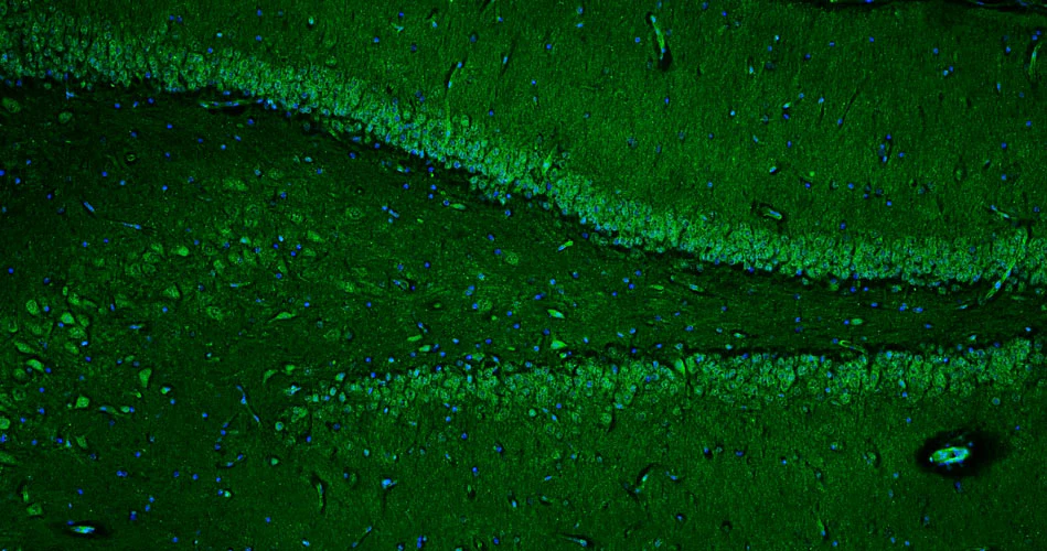 Anti-Ryanodine Receptor Type 2 (RyR2) Recombinant Chicken Chimeric mAb - Image 3