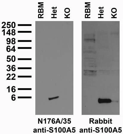 Anti-S100A5 Antibody