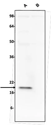 Anti-S100B Antibody - Image 3
