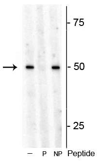 Anti-S6 Kinase 1 (Thr449) Antibody