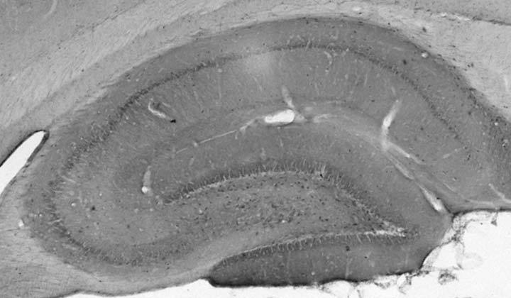 Anti-SALM2/LRFN1 Antibody - Image 2