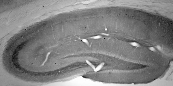 Anti-SALM5/LRFN5 Antibody