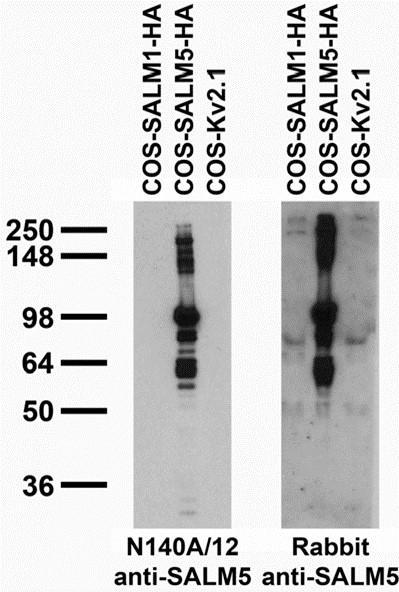 Anti-SALM5/LRFN5 Antibody - Image 3