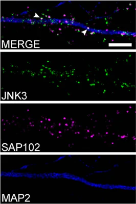Anti-SAP102 Antibody - Image 4