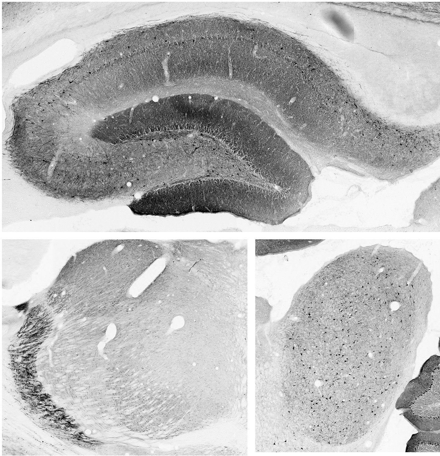 Anti-SAPAP1 Antibody