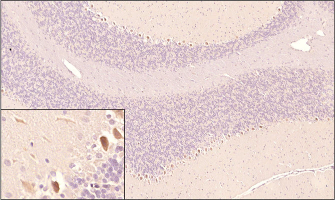 Anti-SARM1 Antibody - Image 3