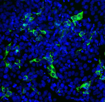 Anti-SARS-CoV-2 S-Protein ACE2 Binding Domain Antibody - Image 2