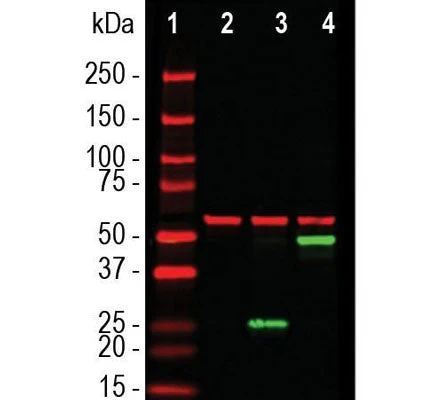 Anti-SARS-CoV-2 S-Protein ACE2 Binding Domain Antibody