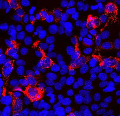 Anti-SARS-CoV-2 S-Protein ACE2 Binding Domain Antibody - Image 2