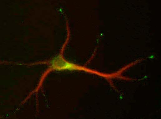 Anti-SCG10/Stathmin-2 Antibody