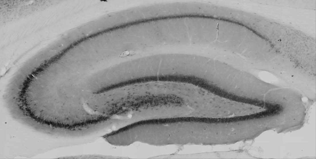Anti-SCG10/Stathmin-2 Antibody - Image 3