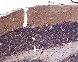 Anti-Semaphorin-3A (Central region) Antibody - Image 2