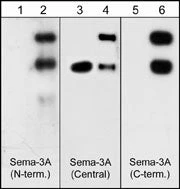 Anti-Semaphorin-3A (N-terminal) Antibody