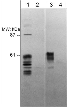 Anti-Semaphorin-3E (N-terminal region) Antibody