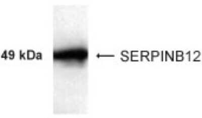 Anti-SERPINB12 Antibody