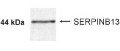 Anti-SERPINB13 Antibody