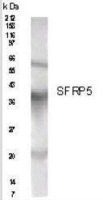 Anti-SFRP5 Antibody