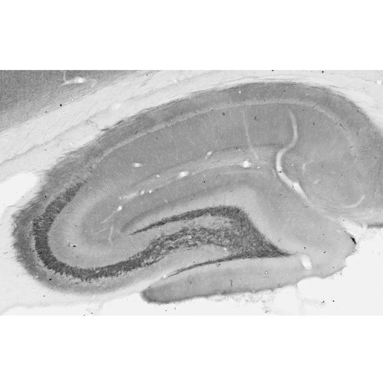 Anti-SH3GL1/Endophilin A2 Antibody