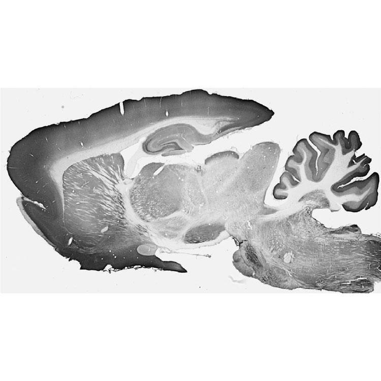Anti-SH3GL1/Endophilin A2 Antibody - Image 2