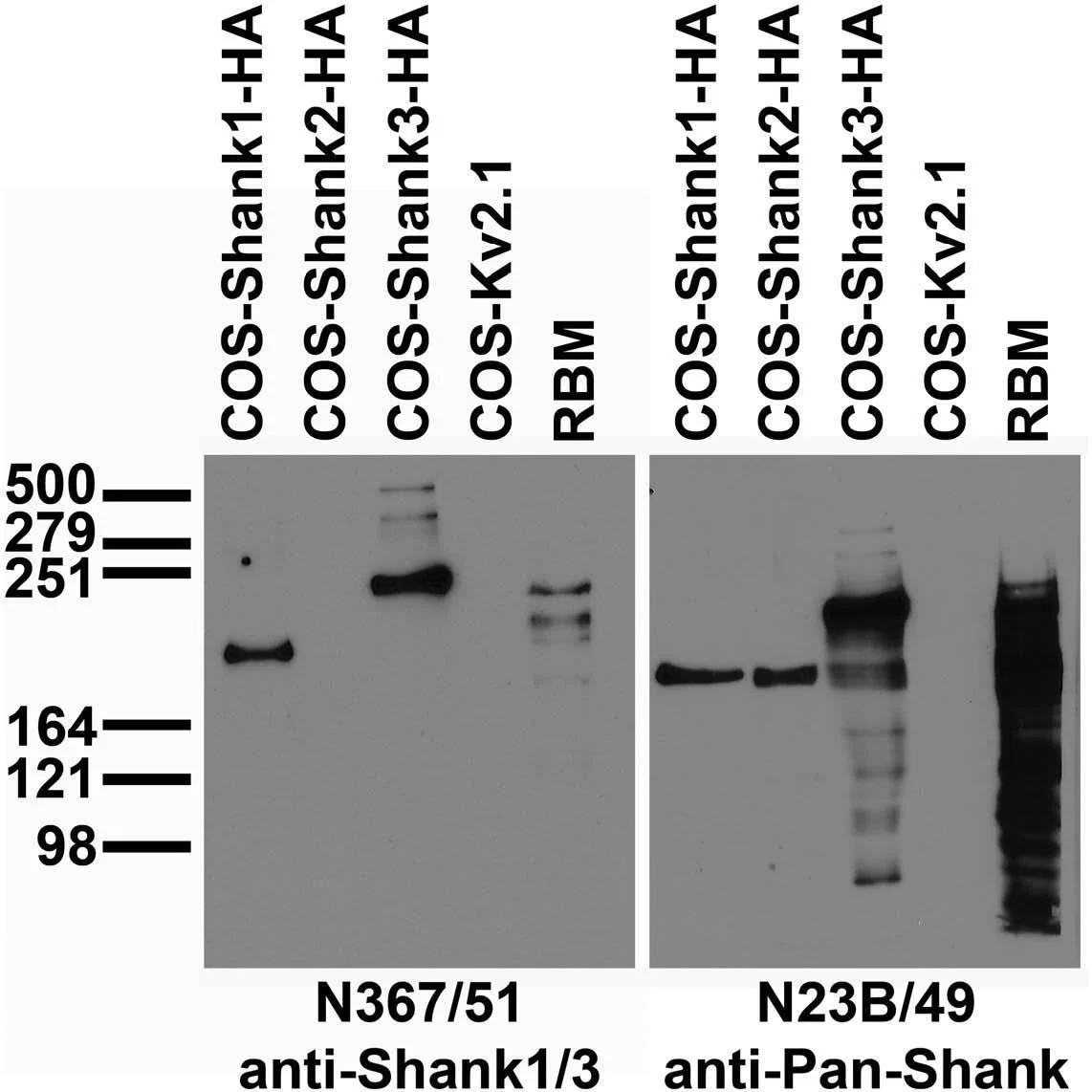 Anti-Shank1 And Shank3 Antibody - Image 2