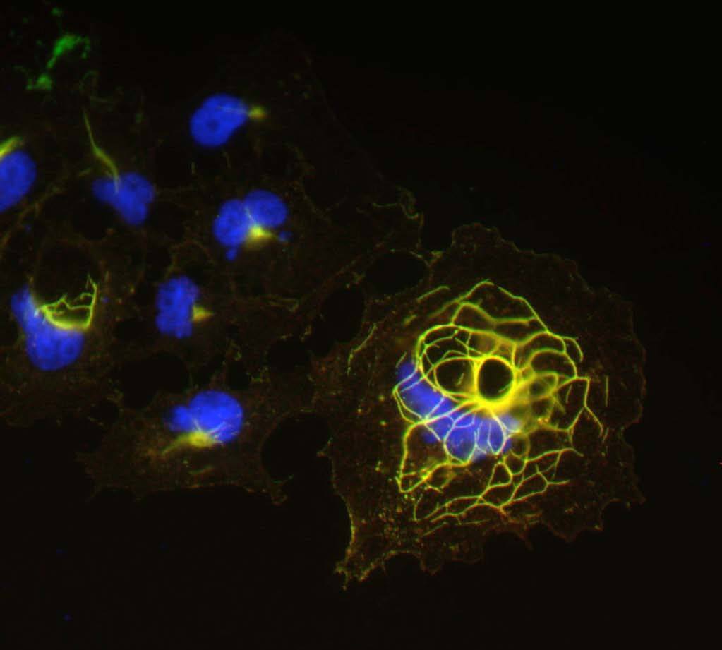 Anti-Shank1 Antibody - Image 2