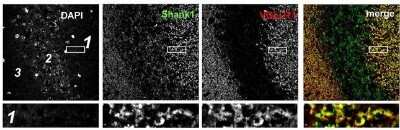 Anti-SHANK1a (C-terminus) Antibody