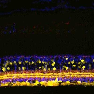 Anti-SHANK1a (C-terminus) Antibody - Image 3