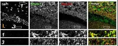 Anti-SHANK1a (C-terminus) Antibody - Image 5