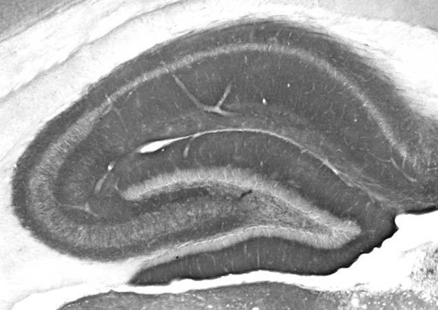 Anti-Shank2 Antibody