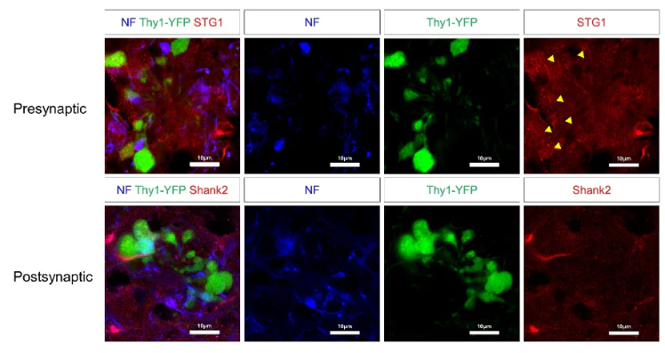 Anti-Shank2 Antibody - Image 4