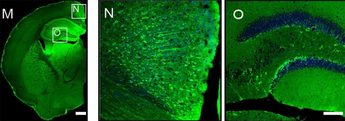 Anti-Shank3 Antibody