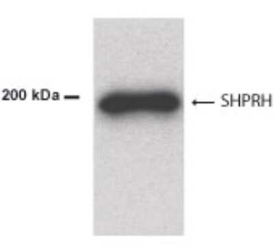 Anti-SHPRH Antibody