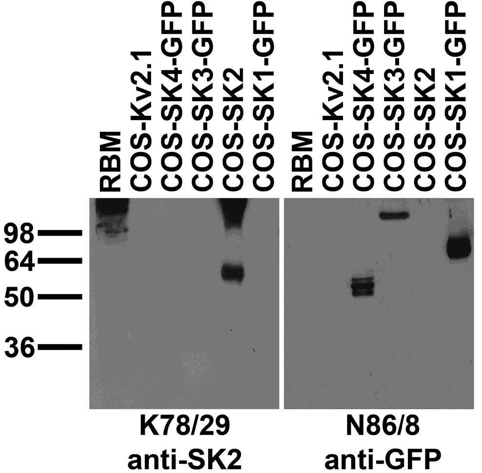 Anti-SK2 potassium channel Antibody - Image 2